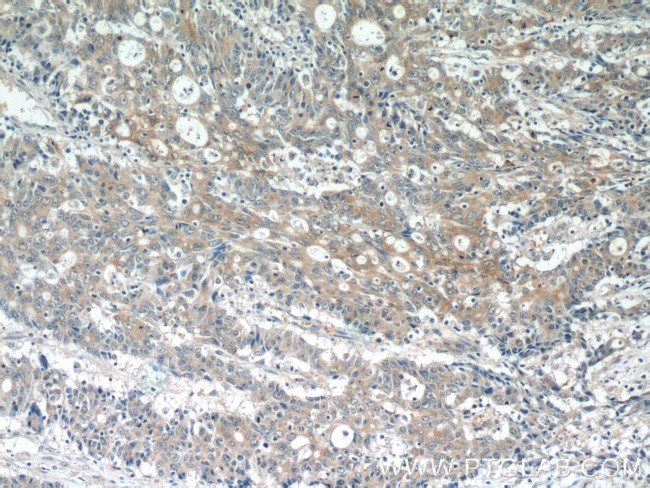 PDE6A Antibody in Immunohistochemistry (Paraffin) (IHC (P))