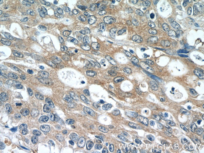 PDE6A Antibody in Immunohistochemistry (Paraffin) (IHC (P))