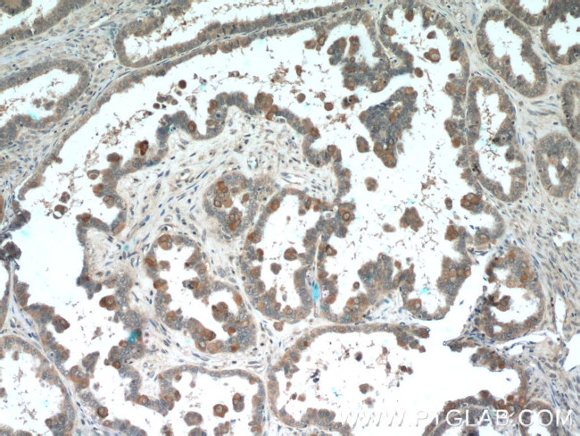 PDE6A Antibody in Immunohistochemistry (Paraffin) (IHC (P))