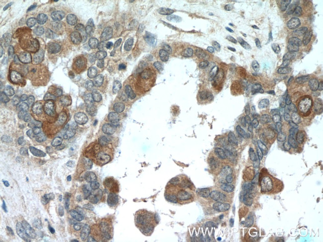 PDE6A Antibody in Immunohistochemistry (Paraffin) (IHC (P))