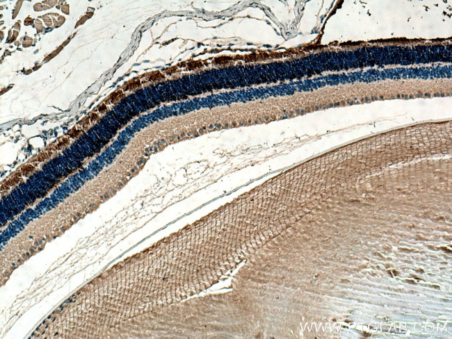 PDE6A Antibody in Immunohistochemistry (Paraffin) (IHC (P))