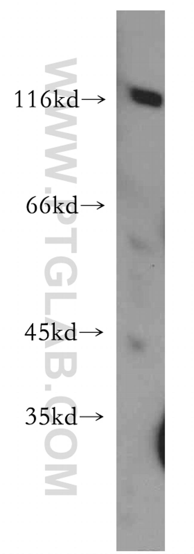 PDE6A Antibody in Western Blot (WB)