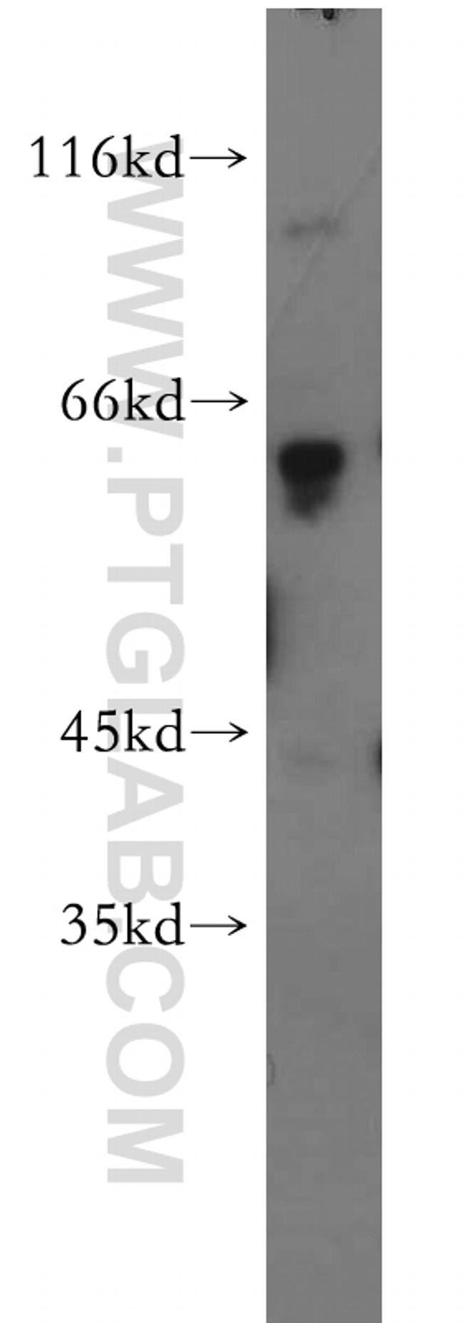 PDE6A Antibody in Western Blot (WB)