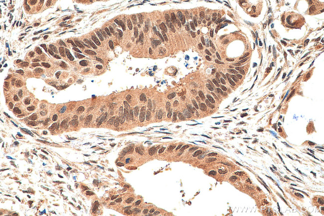 TET2 Antibody in Immunohistochemistry (Paraffin) (IHC (P))