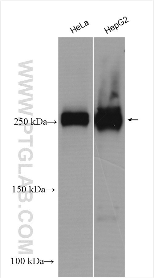 TET2 Antibody in Western Blot (WB)