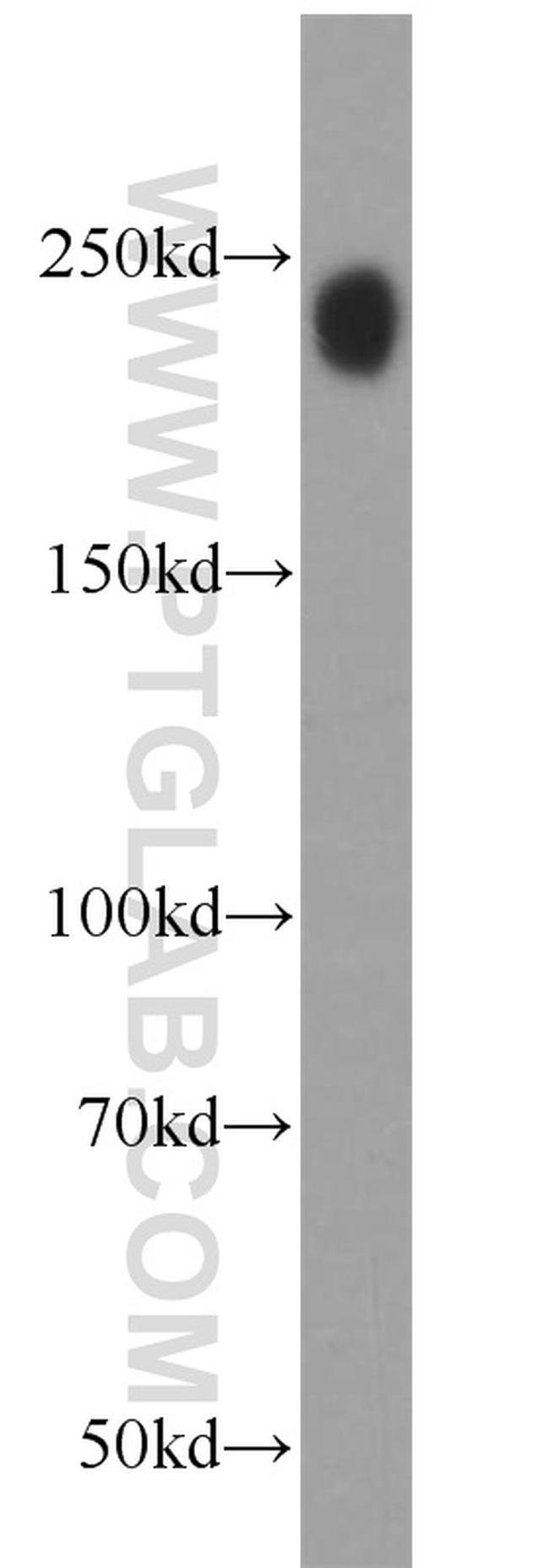 TET2 Antibody in Western Blot (WB)