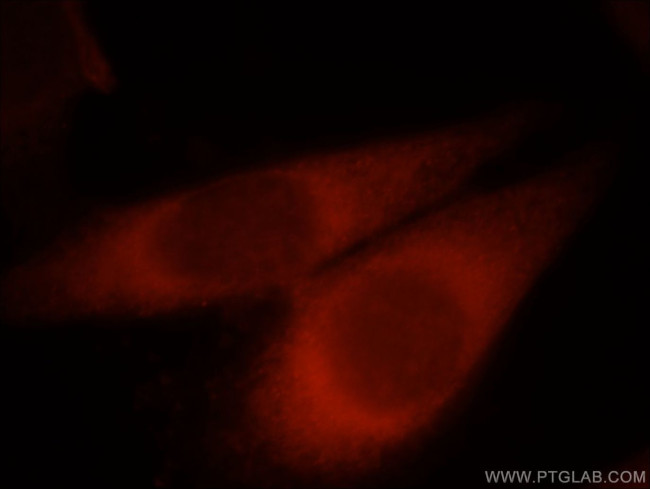 PLOD2 Antibody in Immunocytochemistry (ICC/IF)