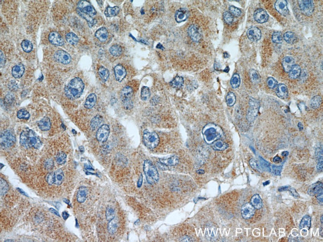 PLOD2 Antibody in Immunohistochemistry (Paraffin) (IHC (P))