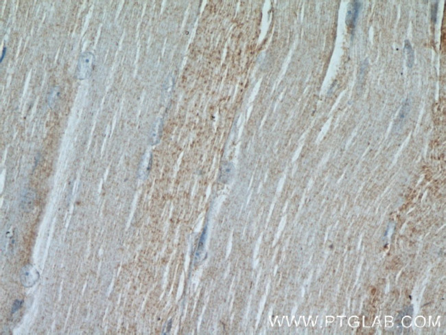 PLOD2 Antibody in Immunohistochemistry (Paraffin) (IHC (P))