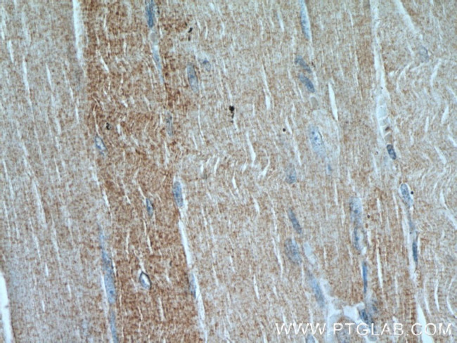 PLOD2 Antibody in Immunohistochemistry (Paraffin) (IHC (P))