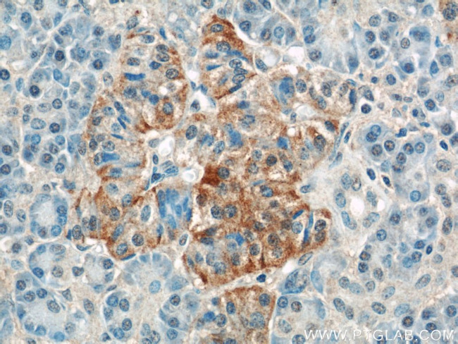 PLOD2 Antibody in Immunohistochemistry (Paraffin) (IHC (P))