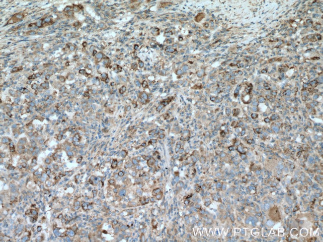 PLOD2 Antibody in Immunohistochemistry (Paraffin) (IHC (P))