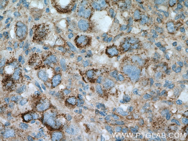 PLOD2 Antibody in Immunohistochemistry (Paraffin) (IHC (P))