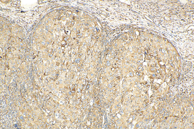 PLOD2 Antibody in Immunohistochemistry (Paraffin) (IHC (P))