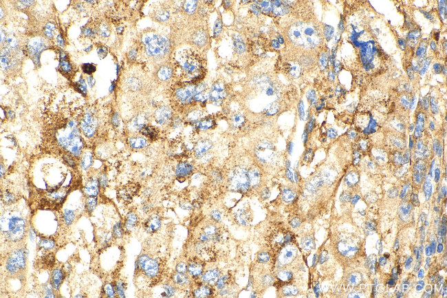 PLOD2 Antibody in Immunohistochemistry (Paraffin) (IHC (P))