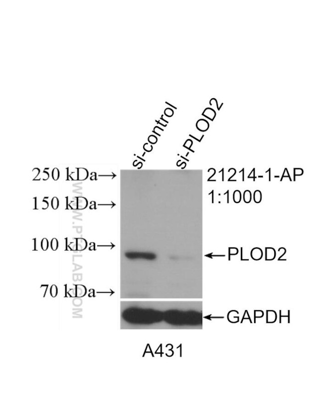 PLOD2 Antibody in Western Blot (WB)