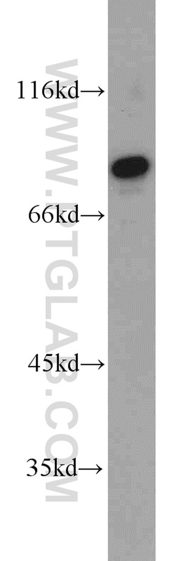 PLOD2 Antibody in Western Blot (WB)