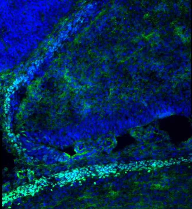 ATOH1 Antibody in Immunohistochemistry (PFA fixed) (IHC (PFA))