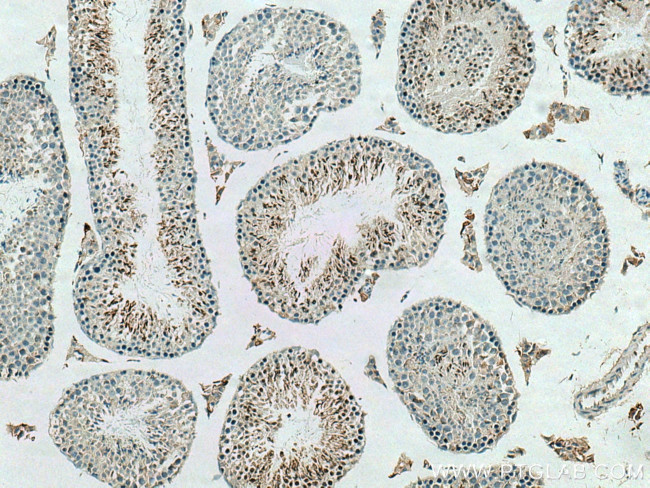 ADAD2 Antibody in Immunohistochemistry (Paraffin) (IHC (P))