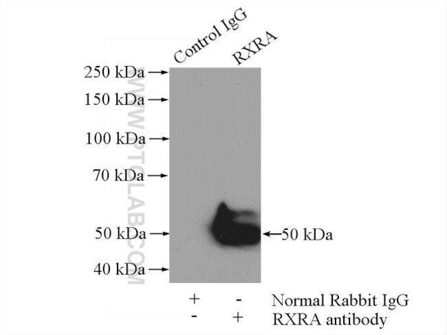 RXRA Antibody in Immunoprecipitation (IP)