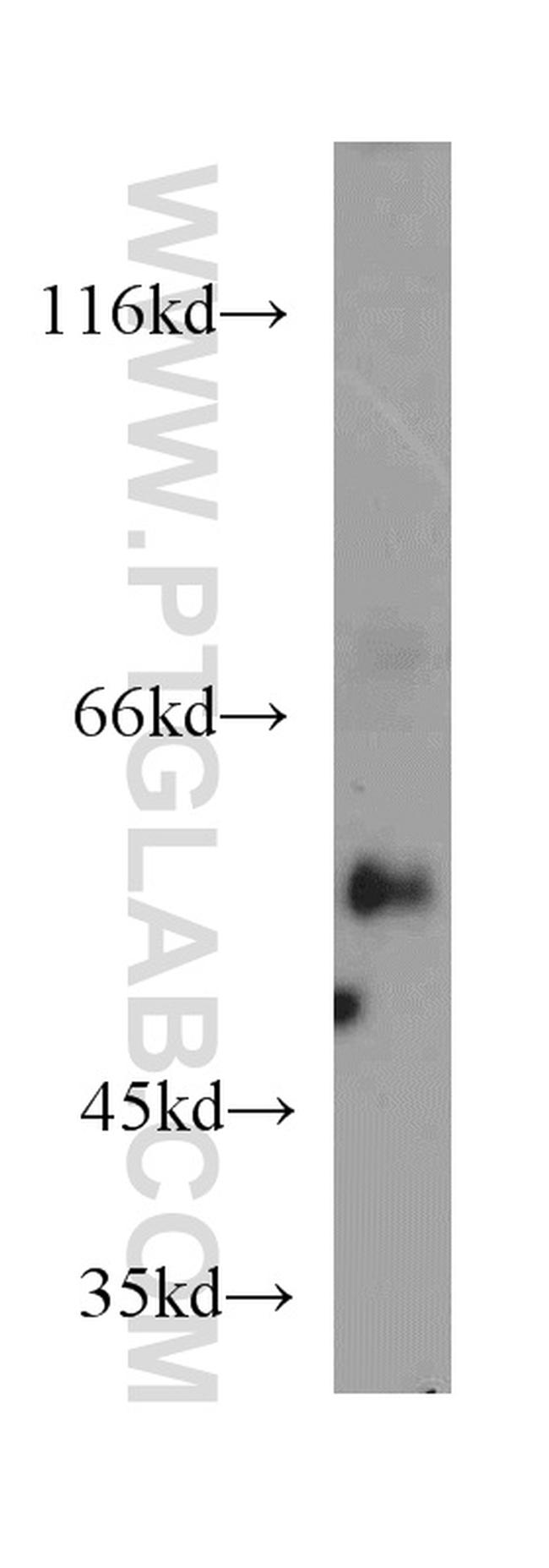 RXRA Antibody in Western Blot (WB)