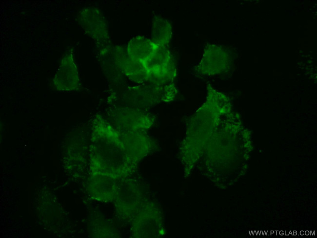 AAMP Antibody in Immunocytochemistry (ICC/IF)