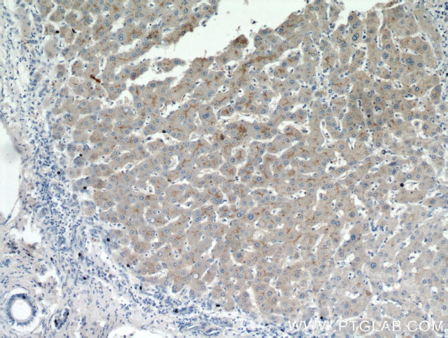 AAMP Antibody in Immunohistochemistry (Paraffin) (IHC (P))