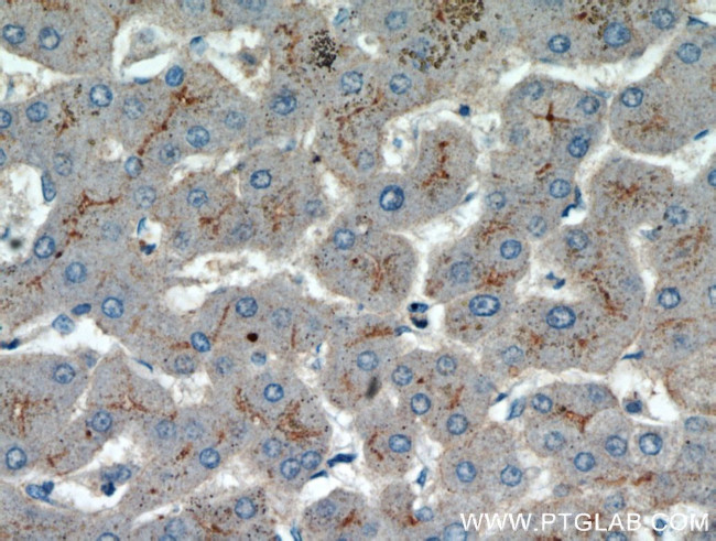 AAMP Antibody in Immunohistochemistry (Paraffin) (IHC (P))