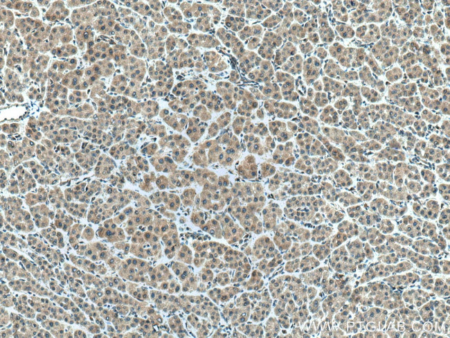 AAMP Antibody in Immunohistochemistry (Paraffin) (IHC (P))