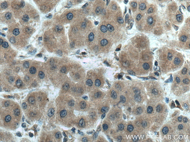 AAMP Antibody in Immunohistochemistry (Paraffin) (IHC (P))