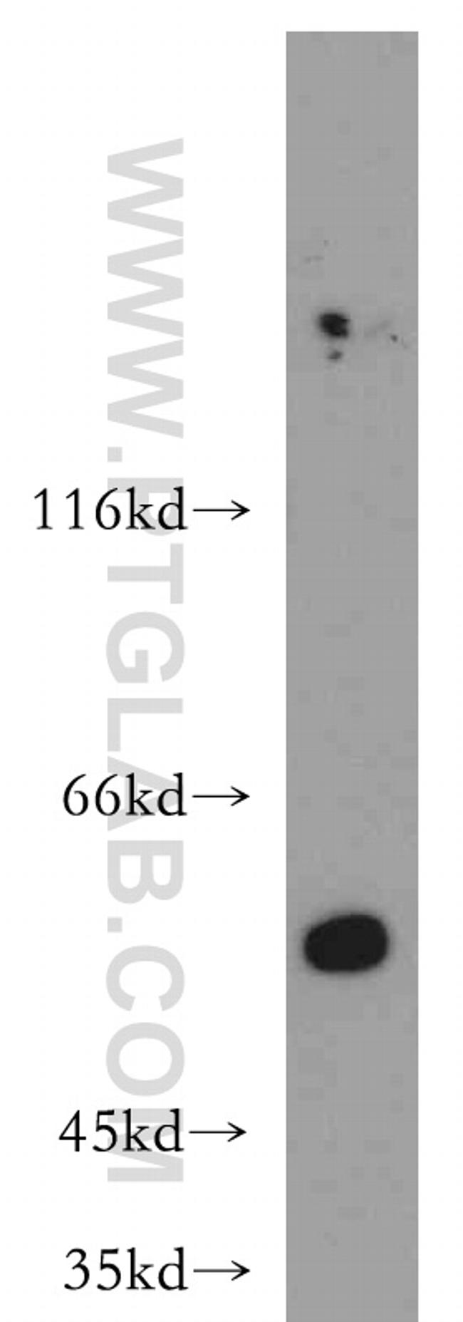 AAMP Antibody in Western Blot (WB)