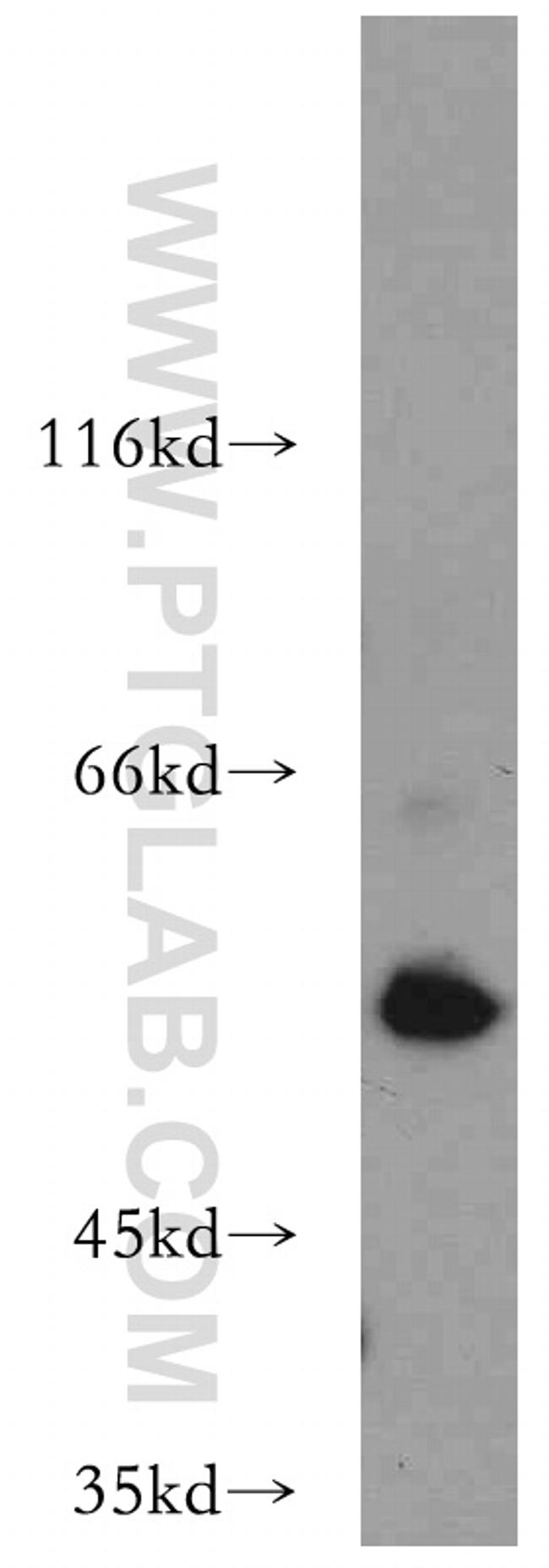 AAMP Antibody in Western Blot (WB)