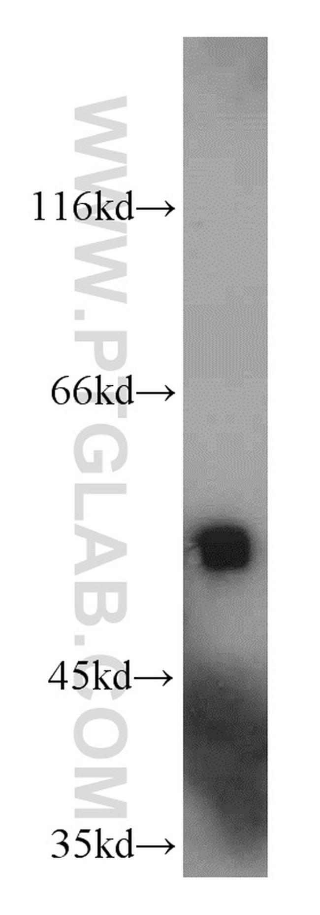 AAMP Antibody in Western Blot (WB)