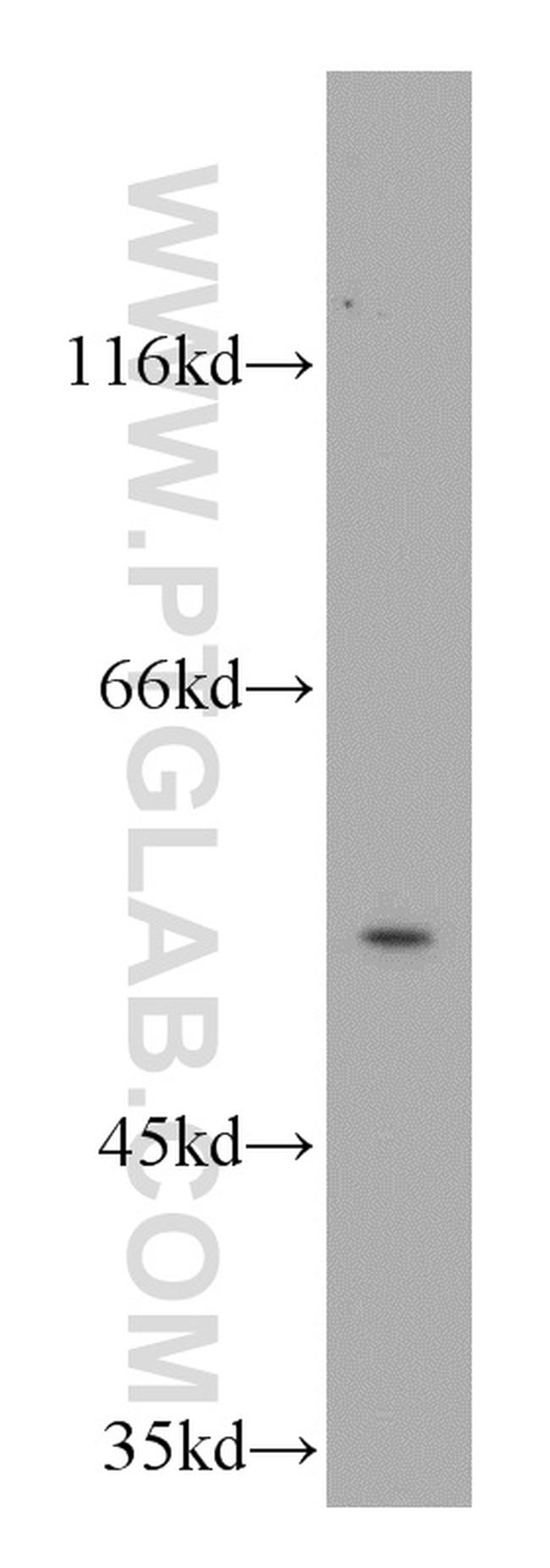 AAMP Antibody in Western Blot (WB)