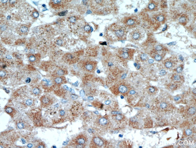 SCO2 Antibody in Immunohistochemistry (Paraffin) (IHC (P))