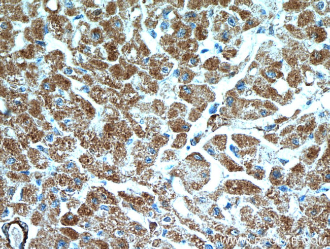 SCO2 Antibody in Immunohistochemistry (Paraffin) (IHC (P))