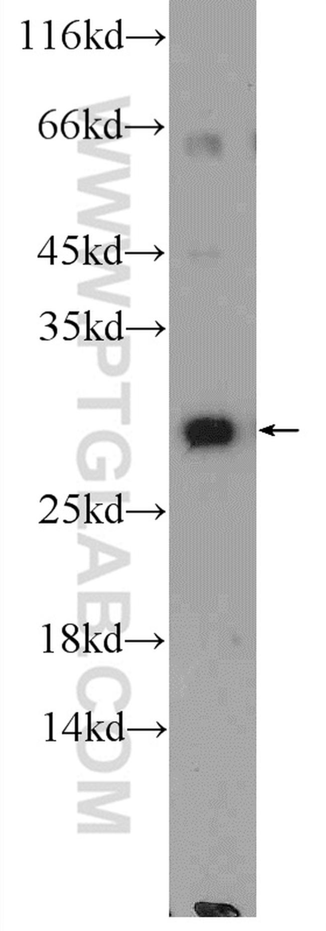 SCO2 Antibody in Western Blot (WB)