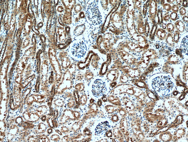 KCNQ1DN Antibody in Immunohistochemistry (Paraffin) (IHC (P))