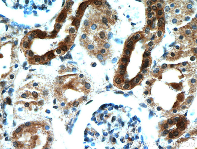 KCNQ1DN Antibody in Immunohistochemistry (Paraffin) (IHC (P))