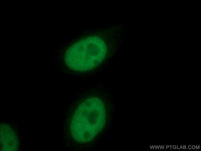 E2A Antibody in Immunocytochemistry (ICC/IF)