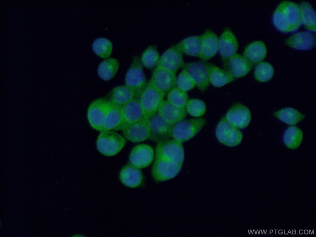 EPS15R Antibody in Immunocytochemistry (ICC/IF)