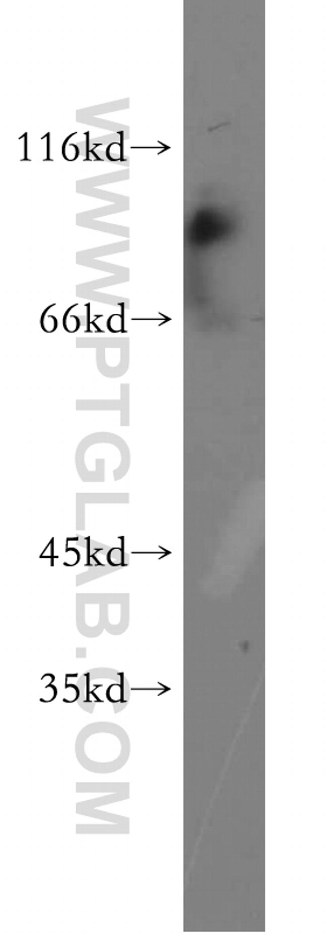 EPS15R Antibody in Western Blot (WB)