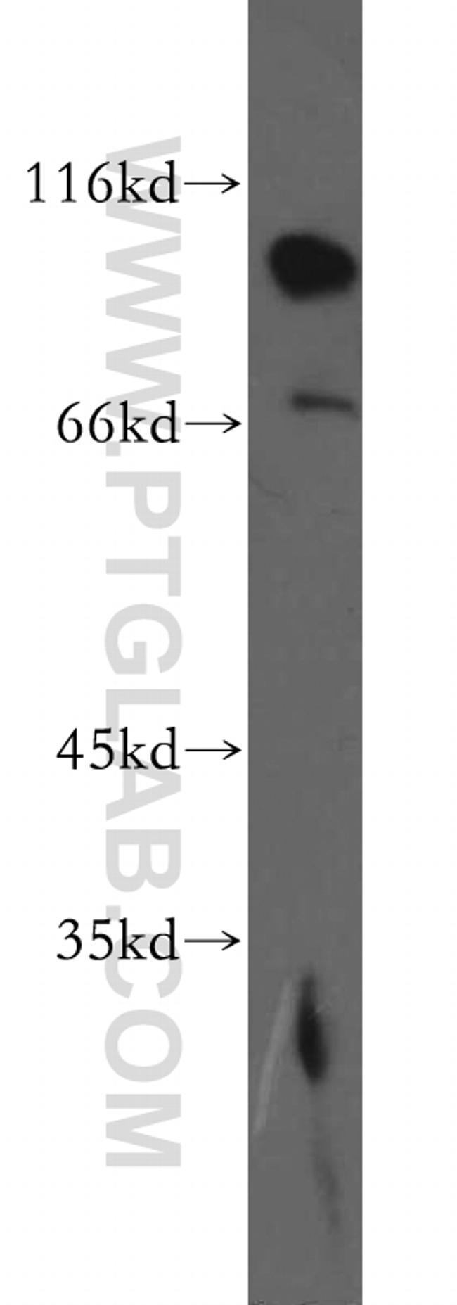 EPS15R Antibody in Western Blot (WB)