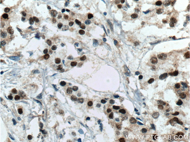 ER Antibody in Immunohistochemistry (Paraffin) (IHC (P))