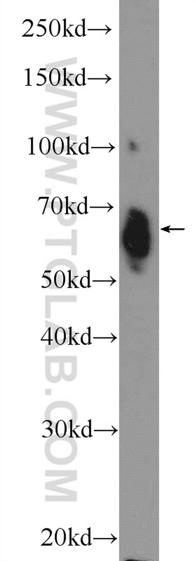 ER Antibody in Western Blot (WB)