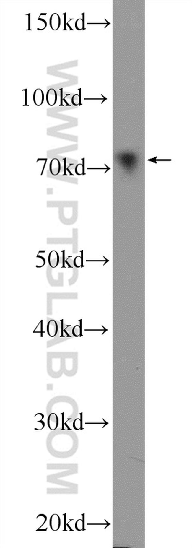 ER Antibody in Western Blot (WB)