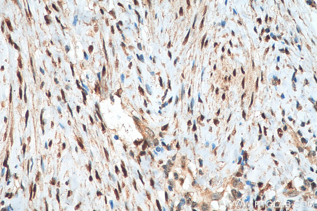 ER Antibody in Immunohistochemistry (Paraffin) (IHC (P))