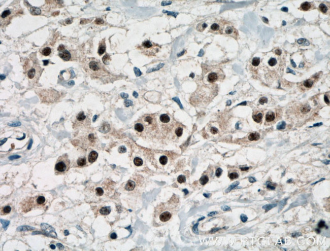 ER Antibody in Immunohistochemistry (Paraffin) (IHC (P))