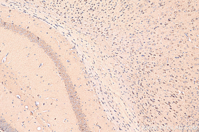 AGRP Antibody in Immunohistochemistry (Paraffin) (IHC (P))