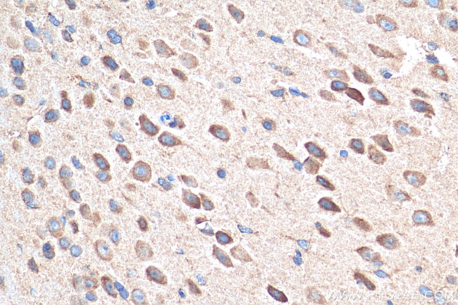 AGRP Antibody in Immunohistochemistry (Paraffin) (IHC (P))